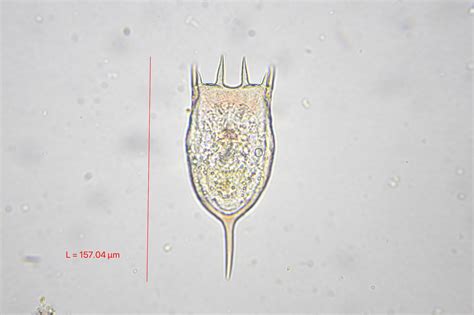  Keratella! A Microscopic Marvel That Makes Waves In Freshwater Ecosystems