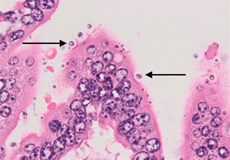  Cryptosporidium: ¡Un parásito microscópico que causa estragos en el intestino!