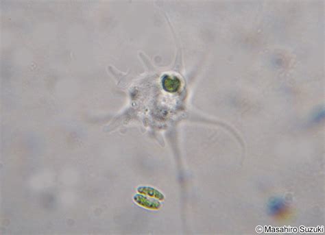  Korotnevella! Un enigmático Amoebozoa que desafía la definición de ser vivo