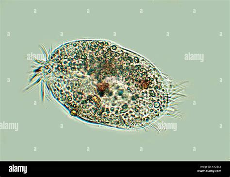  Xeronema: Un Cilioforo Microscópico que Baila con la Corriente y Construye Casitas de Arena